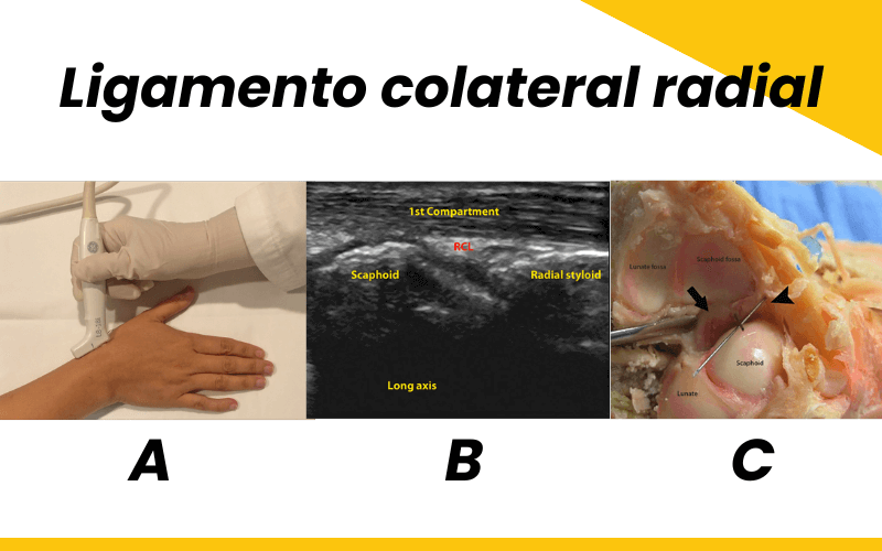 1. Ligamento colateral radial ecografia tempo formacion.png